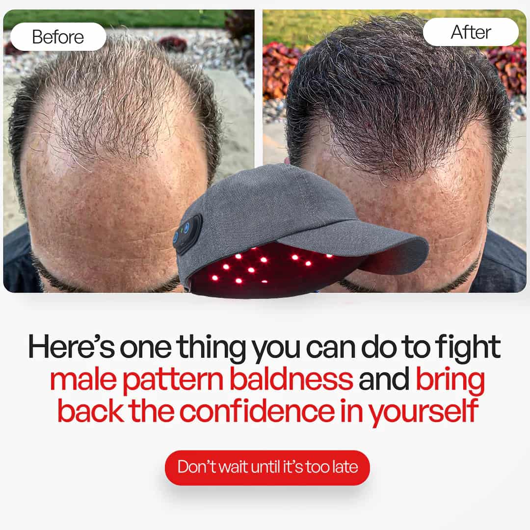 Astarexin Red Light Therapy Cap for Hair Loss Pro