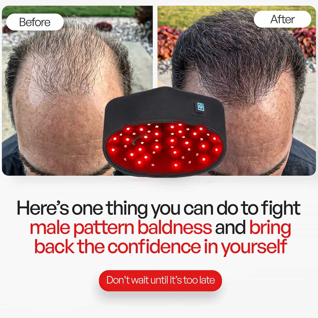 Astarexin Red Light Therapy Cap for Hair Loss